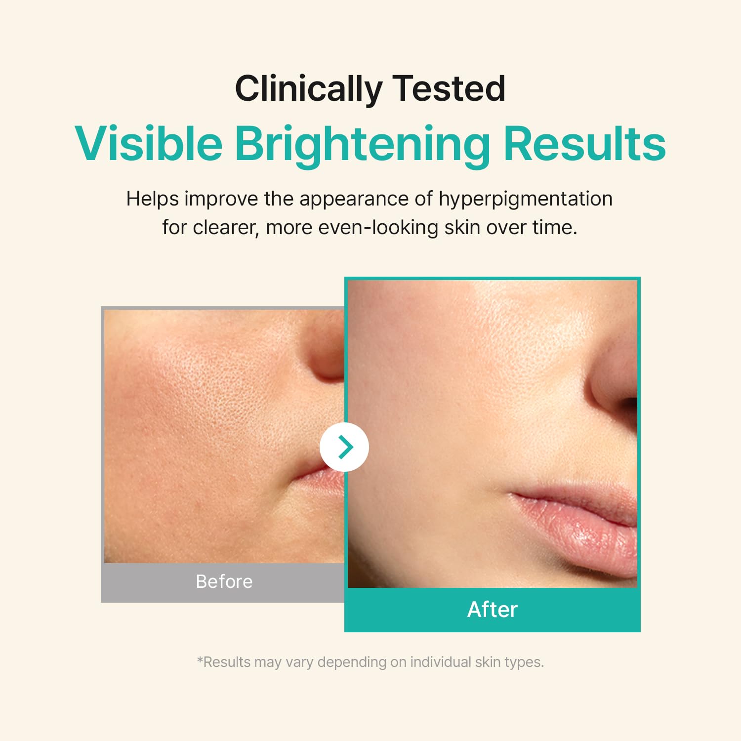 ACWELL serum applied on skin demonstrating dewy finish and glow