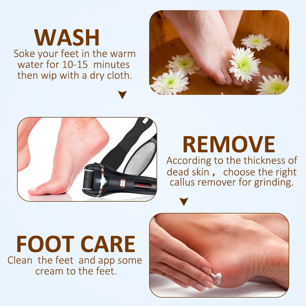 AdamPark in use on heel demonstrating safe removal of hard skin and smoother feet
