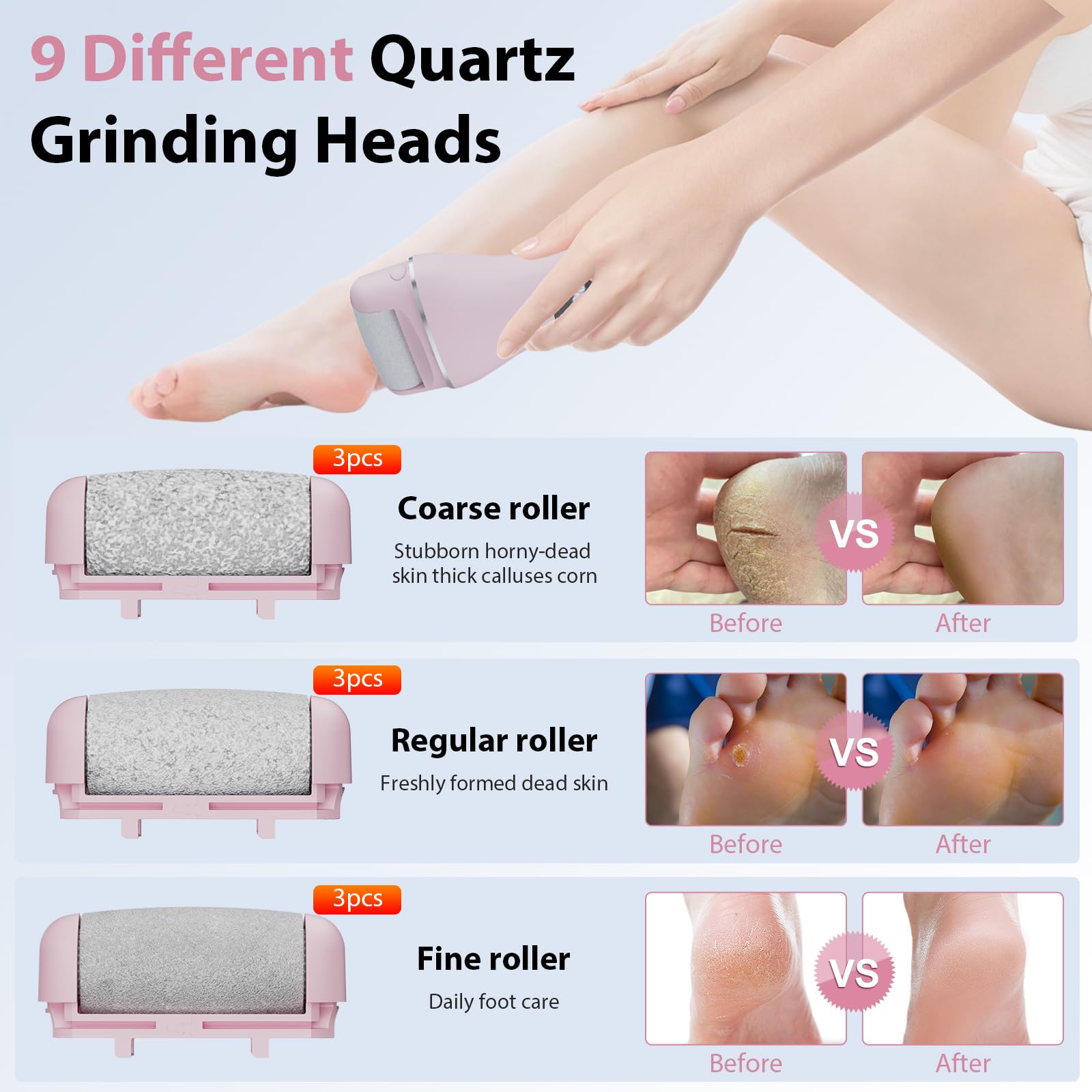 AdamPark close-up of oversized quartz roller head highlighting abrasive texture for faster dead skin removal