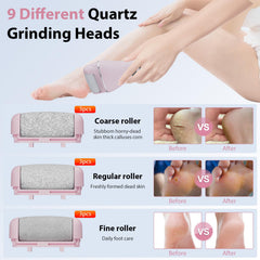AdamPark close-up of oversized quartz roller head highlighting abrasive texture for faster dead skin removal