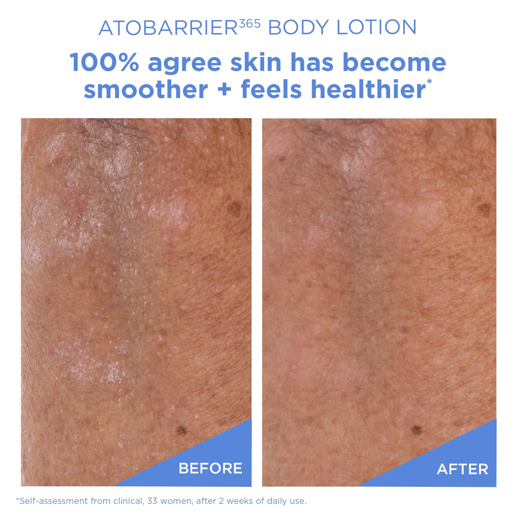 AESTURA ceramide microcapsules graphic showing targeted barrier support