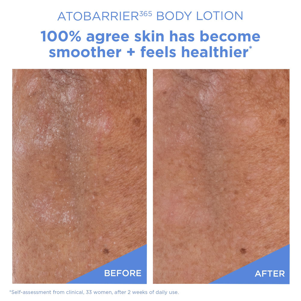 AESTURA ceramide microcapsules graphic showing targeted barrier support