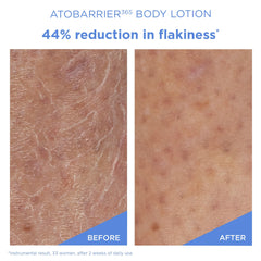 AESTURA creamy lotion texture close-up for fast-absorbing hydration