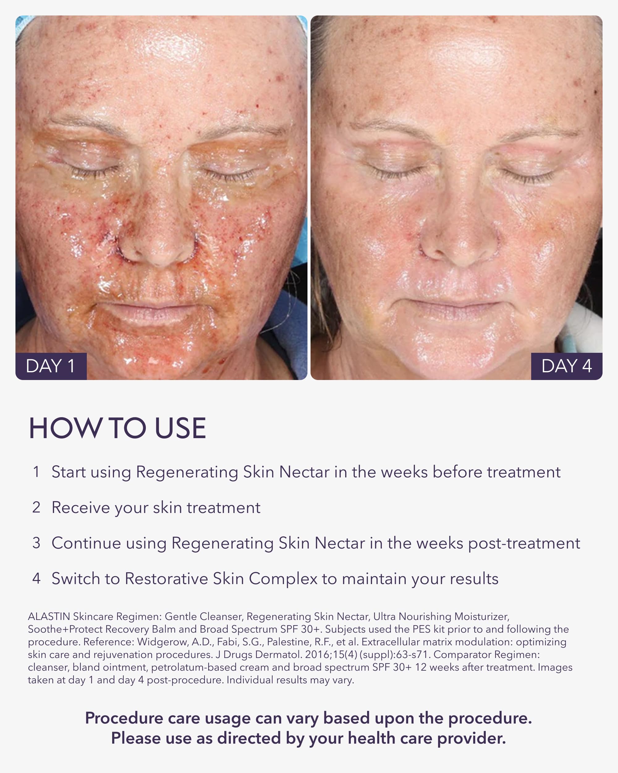 ALASTIN Skincare being applied post-procedure demonstrating soothing benefit