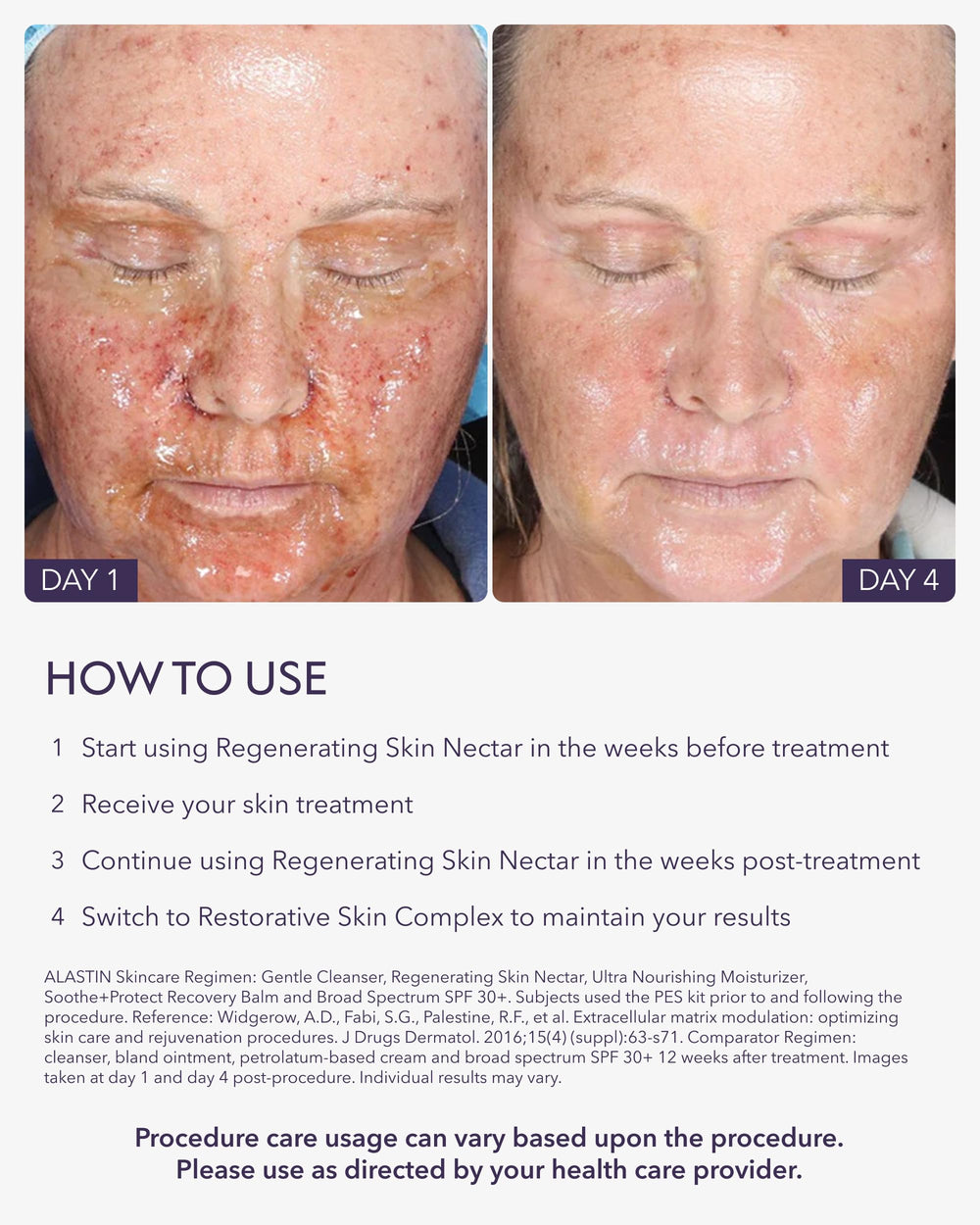 ALASTIN Skincare being applied post-procedure demonstrating soothing benefit