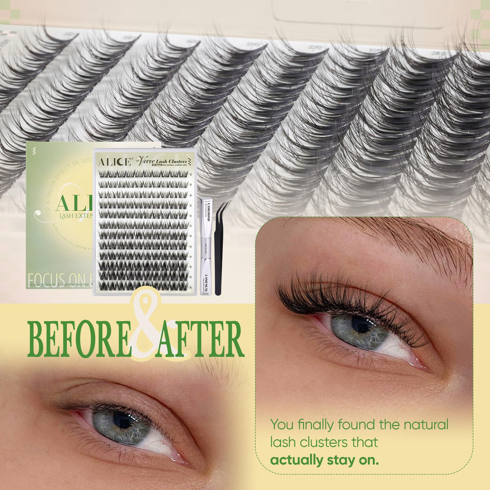 ALICE Verve arranged 10–16mm lengths showing customizable length options