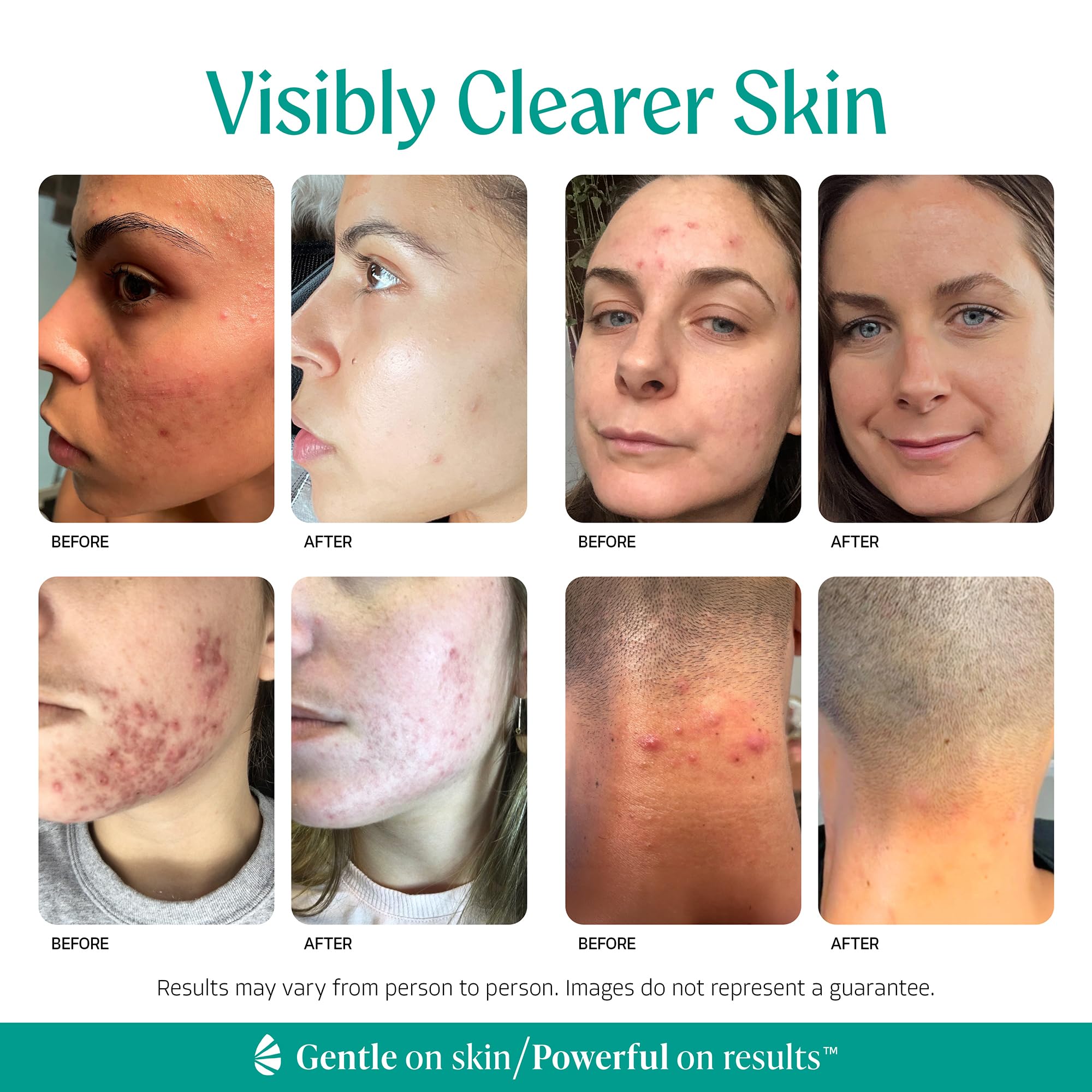 Almond Clear pump dispensing serum for easy targeted application benefit