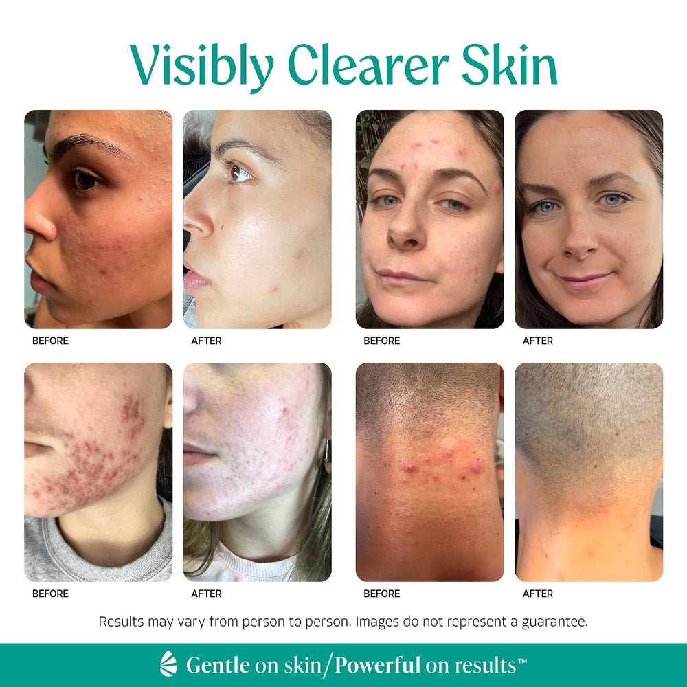 Almond Clear pump dispensing serum for easy targeted application benefit
