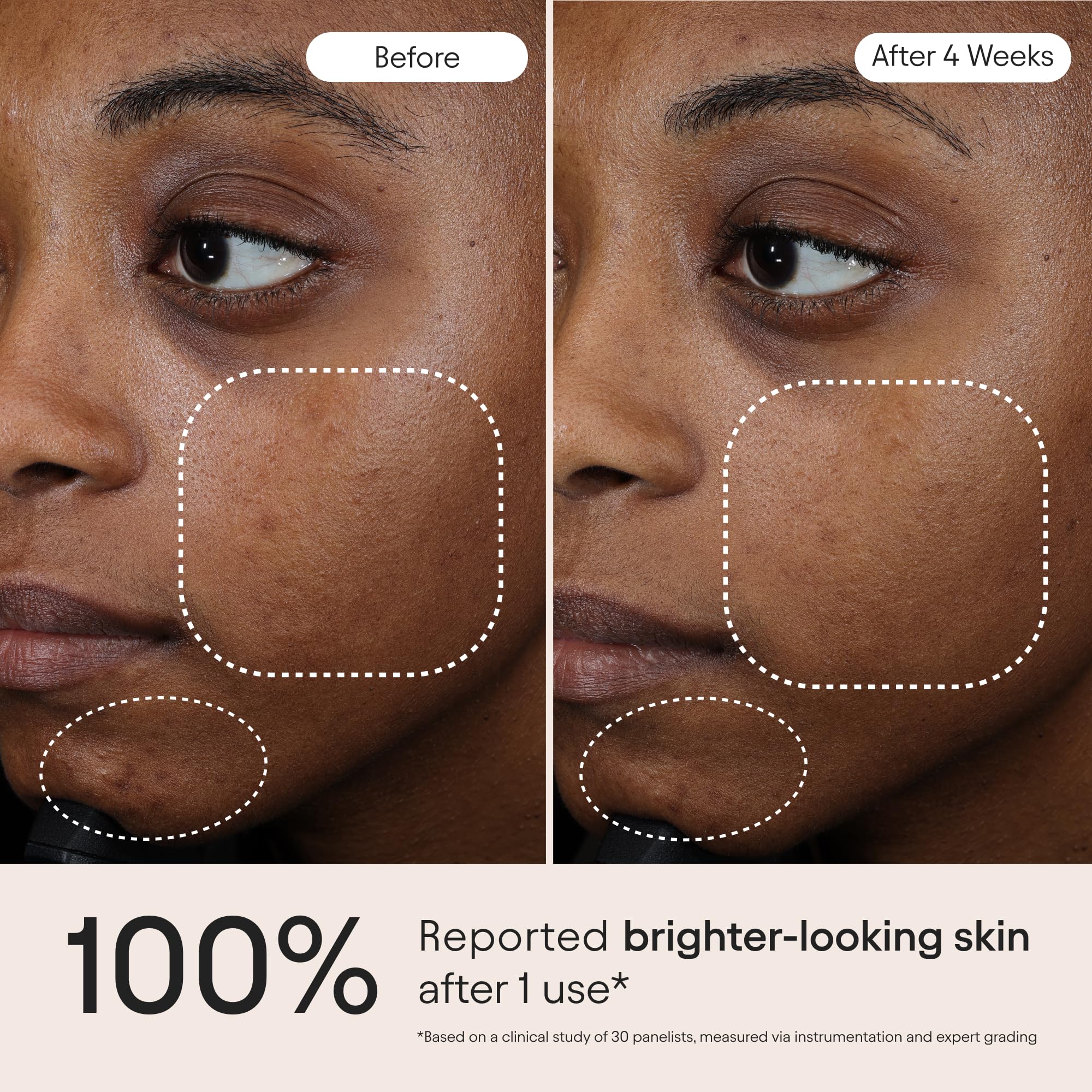 Alpyn Beauty pump application on hand illustrating easy, mess-free use
