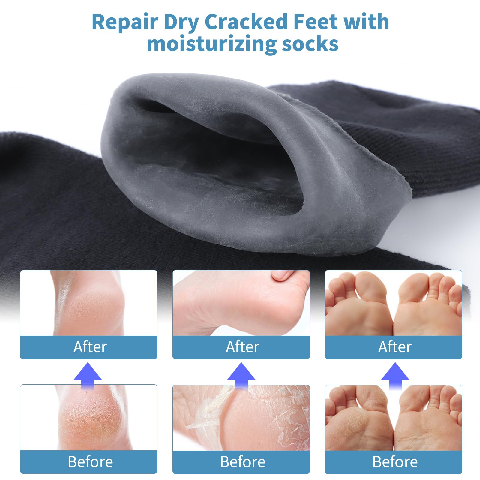 ALUROICE socks on a male foot demonstrating fit and enhanced moisturizer retention