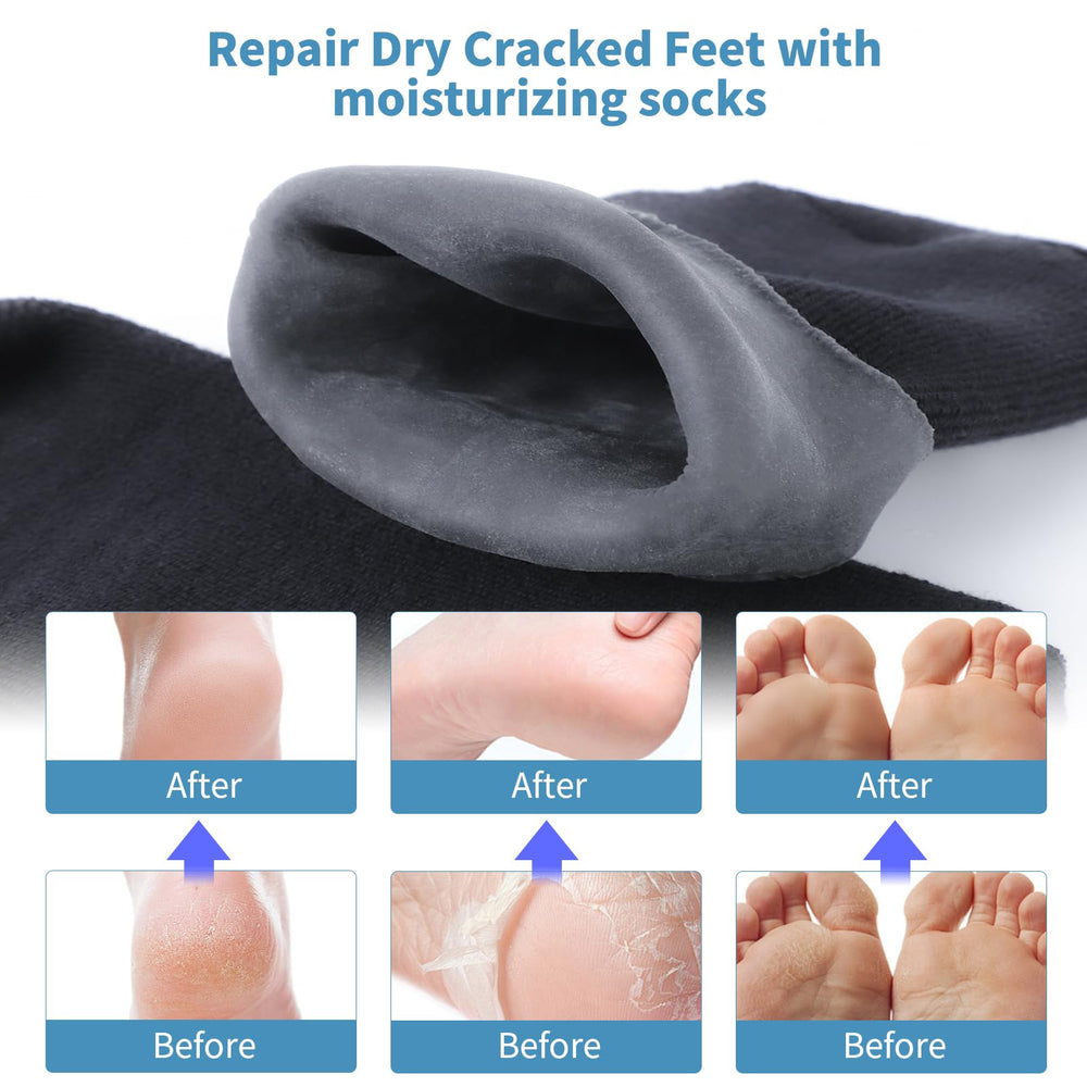 ALUROICE socks on a male foot demonstrating fit and enhanced moisturizer retention