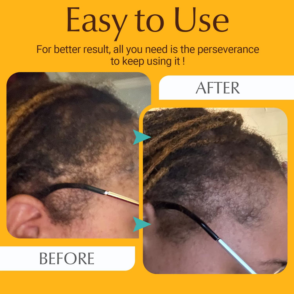 ANTMPO comb in use on dry hair showing gentle detangling and improved manageability
