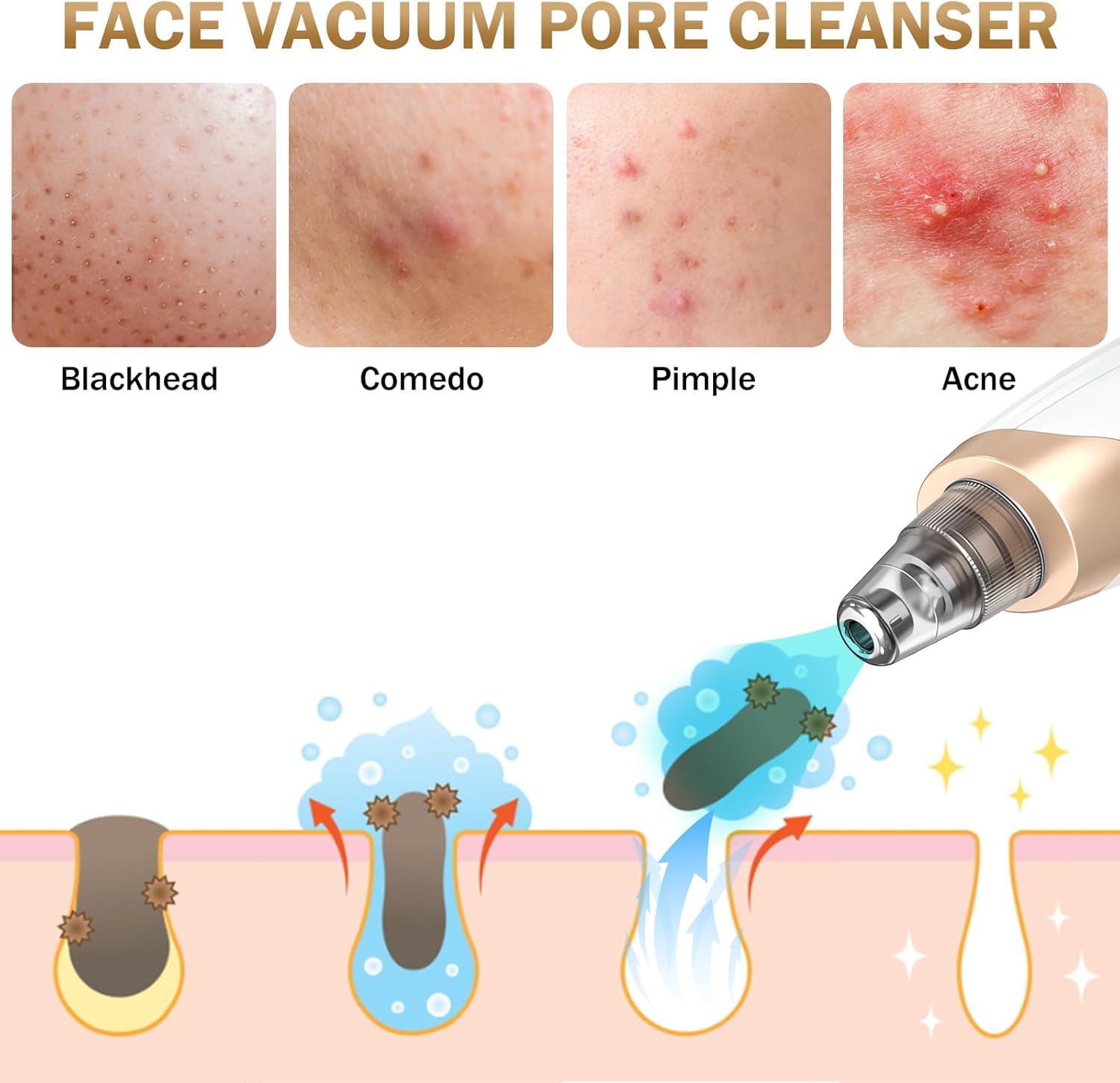 Aooeou suction tip texture detail demonstrating gentle contact benefit