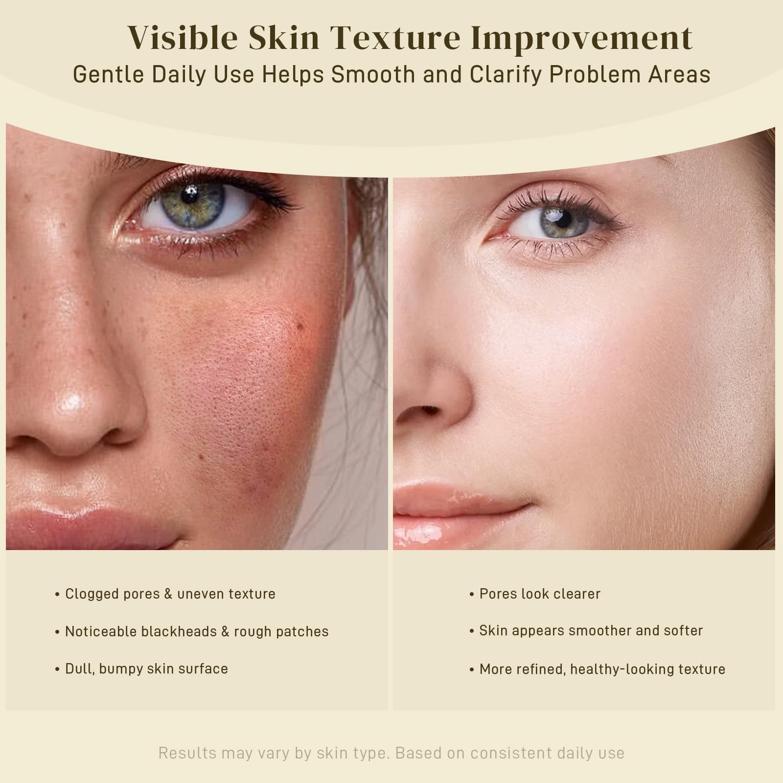 AOPO before and after swipe comparison showing refined appearance