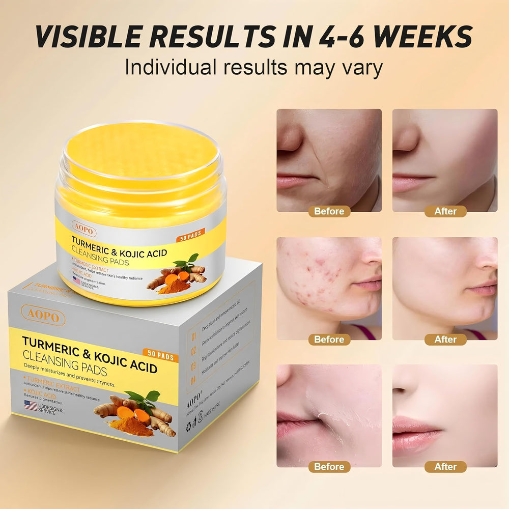 AOPO ingredient label close-up highlighting kojic acid and turmeric