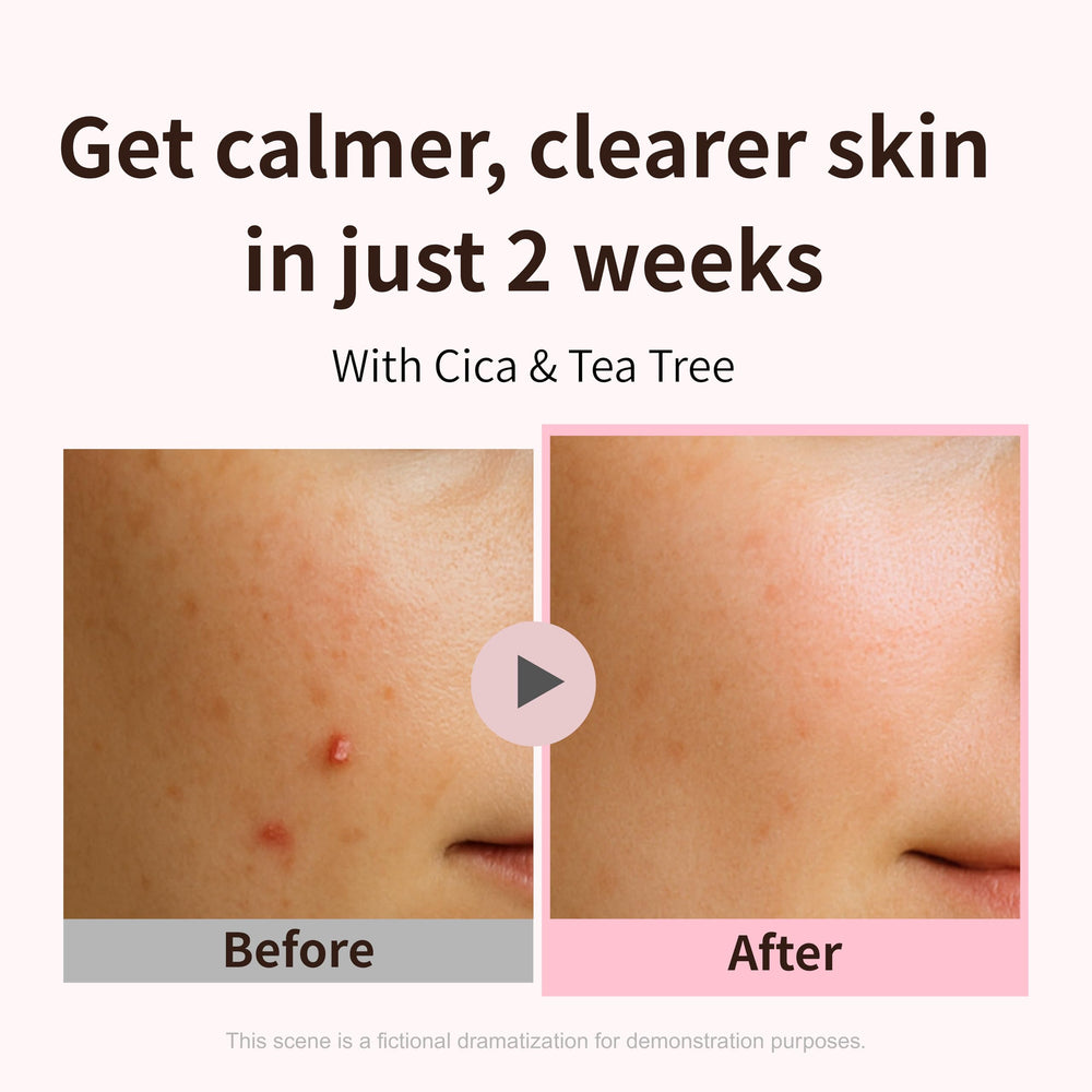 aplin cream texture close-up demonstrating lightweight, quick-absorbing benefit