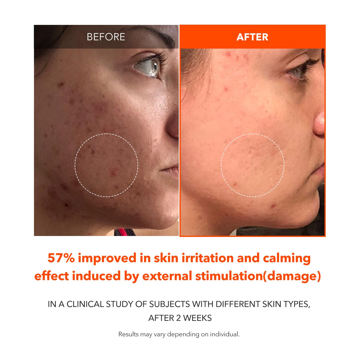 APRILSKIN close-up of ingredient label emphasizing carotenoid-based brightening benefit