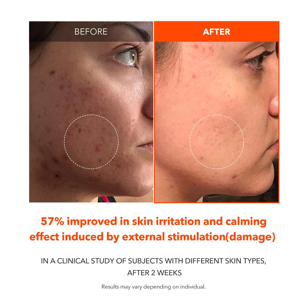 APRILSKIN close-up of ingredient label emphasizing carotenoid-based brightening benefit