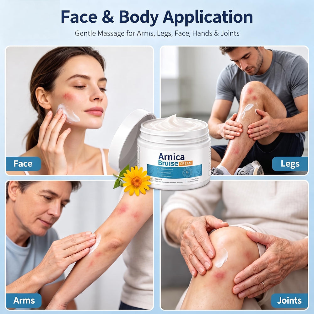 ARIYE application on arm showing quick bruise coverage benefit