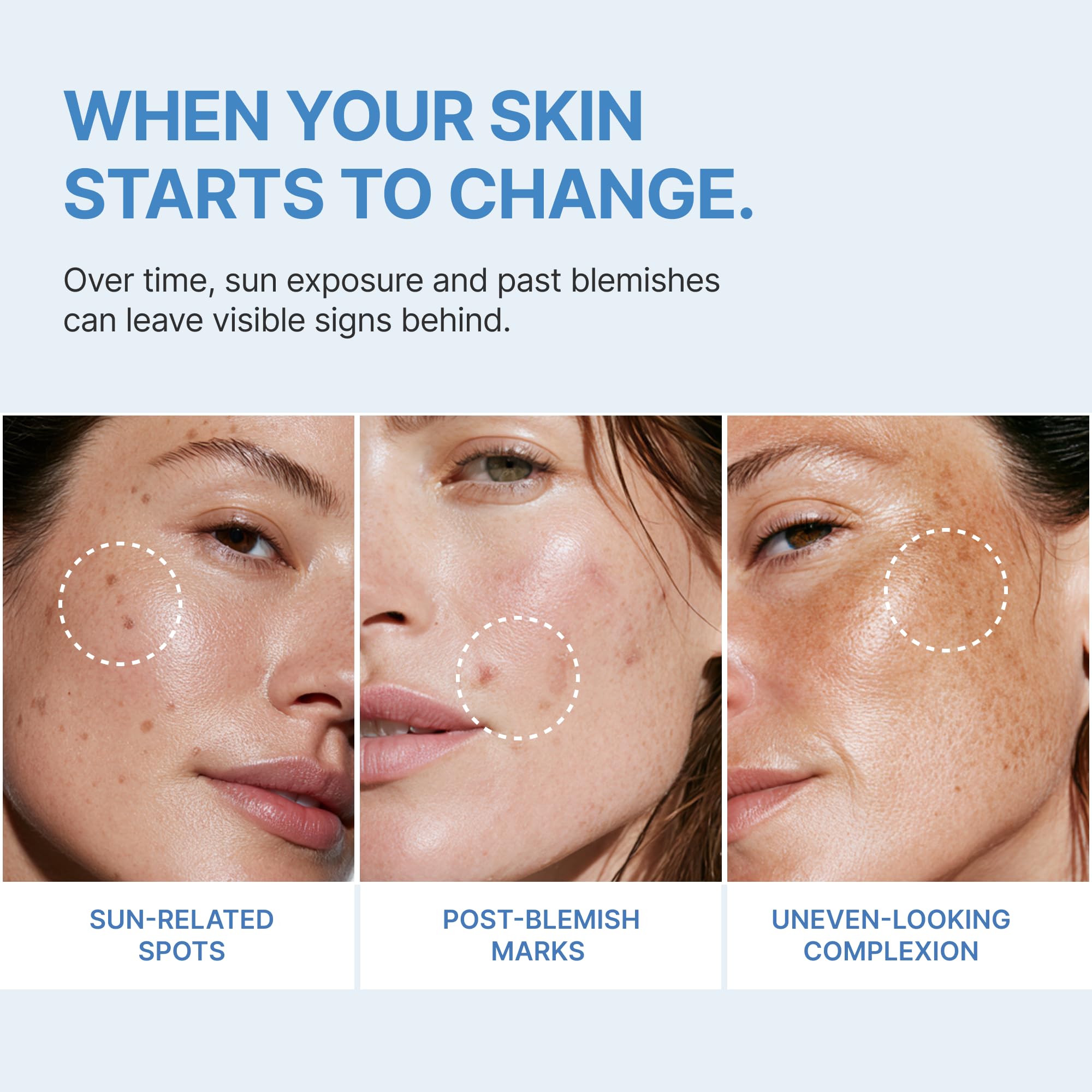 Ashania applied to cheek demonstrating targeted dark spot coverage and even tone