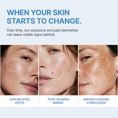 Ashania applied to cheek demonstrating targeted dark spot coverage and even tone