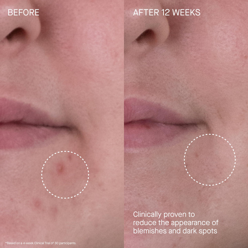 Augustinus Bader cream massaged into neck and décolleté for hydrated skin