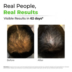 AVIMEE HERBAL label detail highlighting key herbs and mineral-oil-free claim