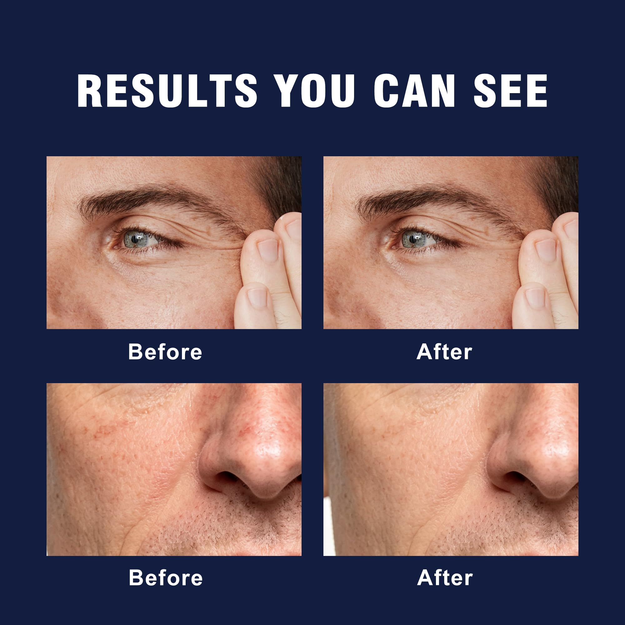 AVITAPURE applied after shaving to soothe skin and reduce redness