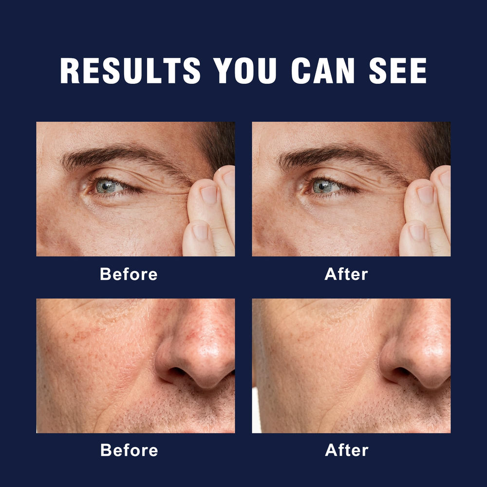 AVITAPURE applied after shaving to soothe skin and reduce redness