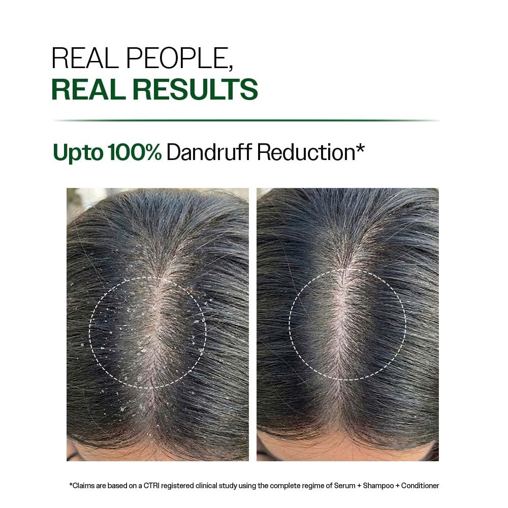 Bare Anatomy shampoo lather closeup showing rich foam and effective cleanse