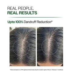 Bare Anatomy shampoo lather closeup showing rich foam and effective cleanse