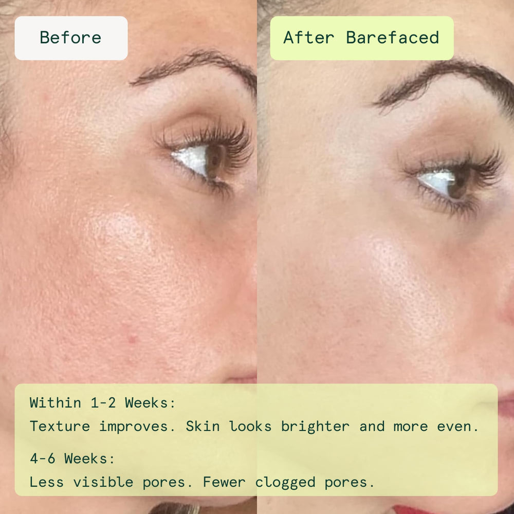Barefaced close-up of dual-textured pad, showing exfoliating surface for smoothness