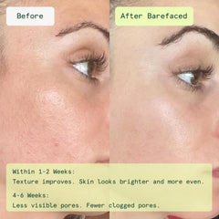 Barefaced close-up of dual-textured pad, showing exfoliating surface for smoothness