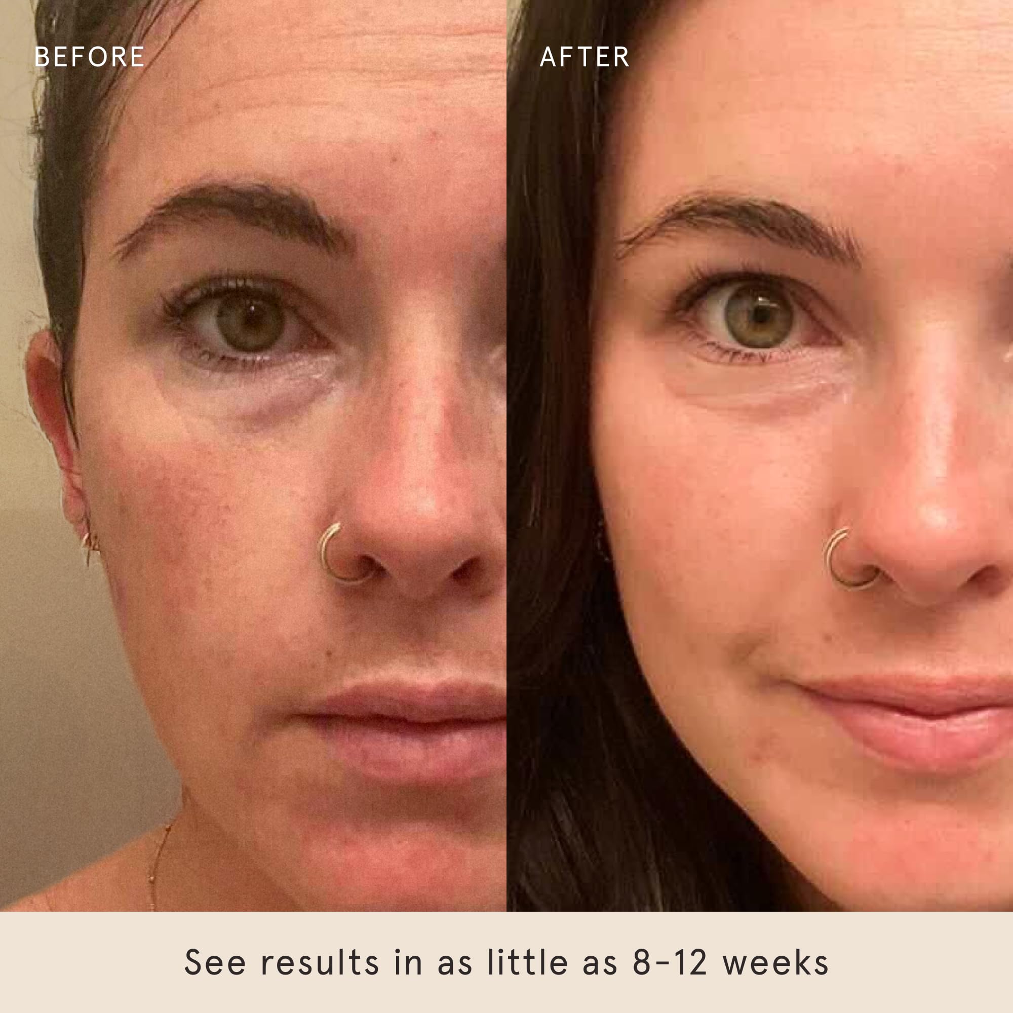 Barefaced before and after comparison demonstrating minimized pores and smoother skin
