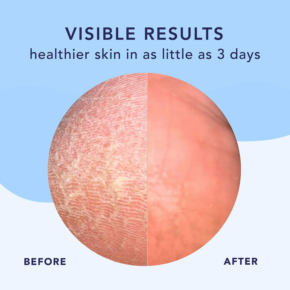 Barefoot Scientist ingredient list graphic showcasing hyaluronic acid and urea benefits