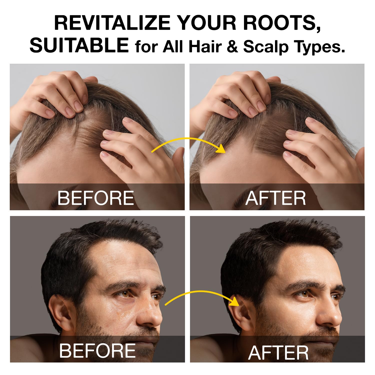 Beadlamey in-shower use lathering at scalp for improved scalp comfort