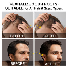 Beadlamey in-shower use lathering at scalp for improved scalp comfort