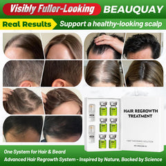BeauQuay applicator device detail for precise scalp delivery