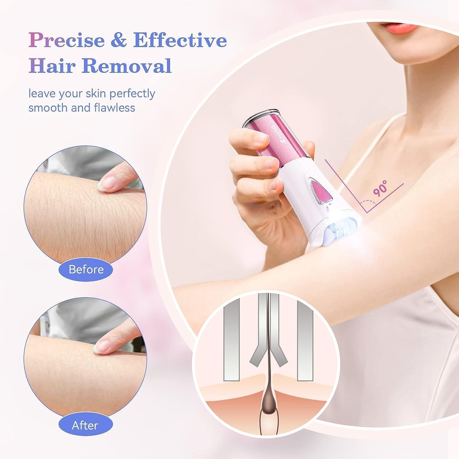 BEAUZMO close-up of epilation head detailing blades for precise removal