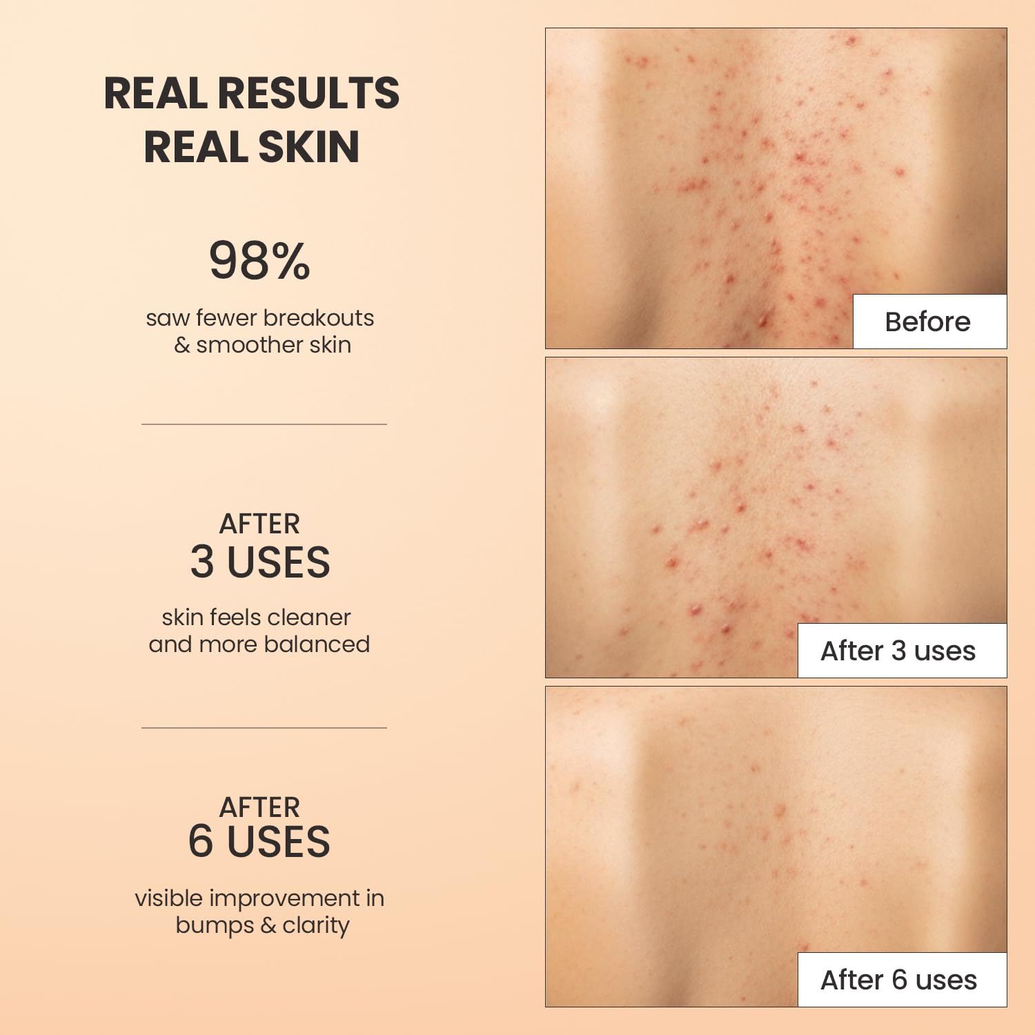 BellamiLuxx scrub in hand being applied for effective pore clearing