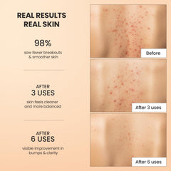 BellamiLuxx scrub in hand being applied for effective pore clearing
