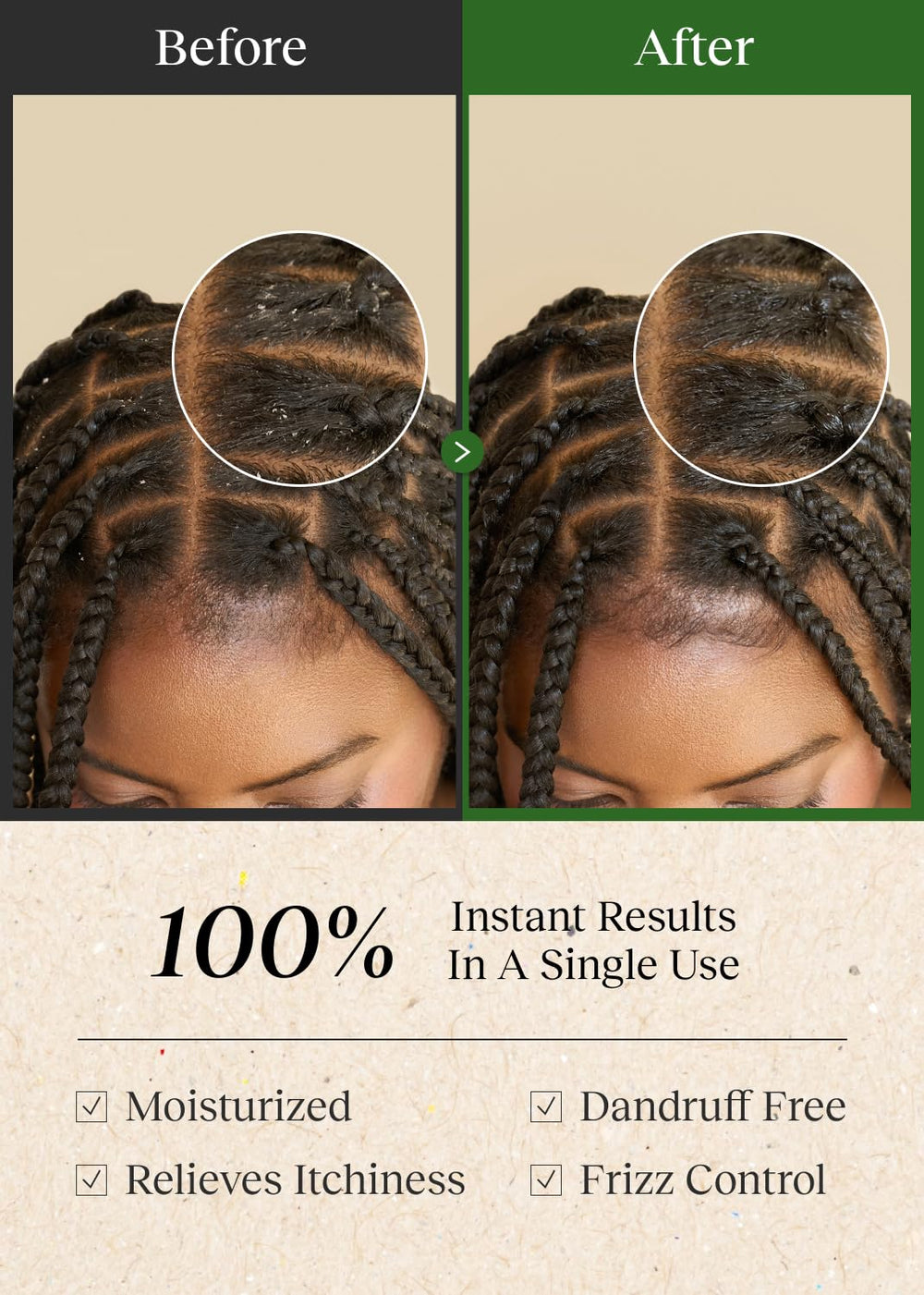 BEPHOR demonstrated wiping scalp part to remove buildup, helps refresh braids