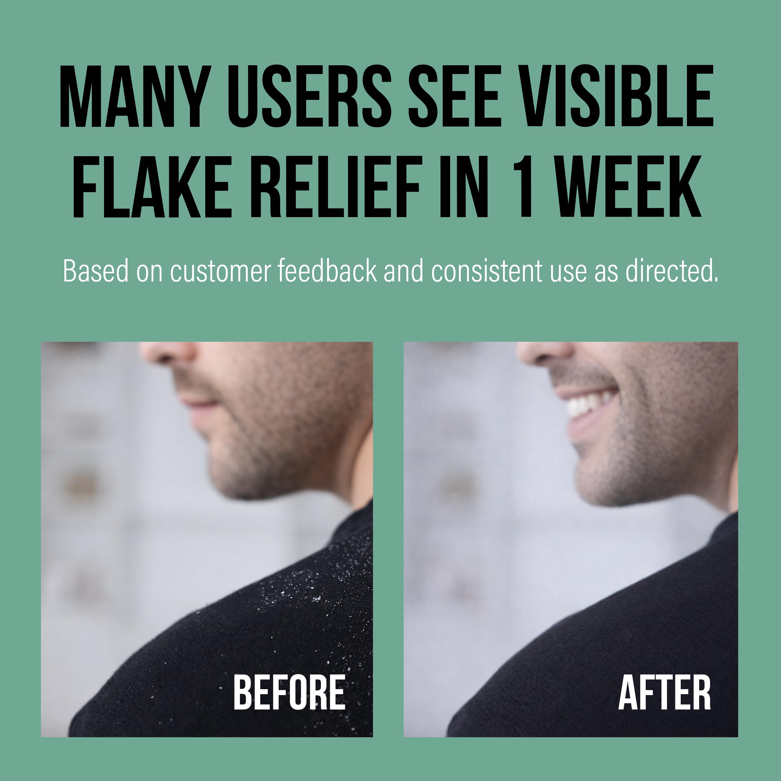 Berk's full spectrum illustration of scale reduction showing before and after scalp benefit