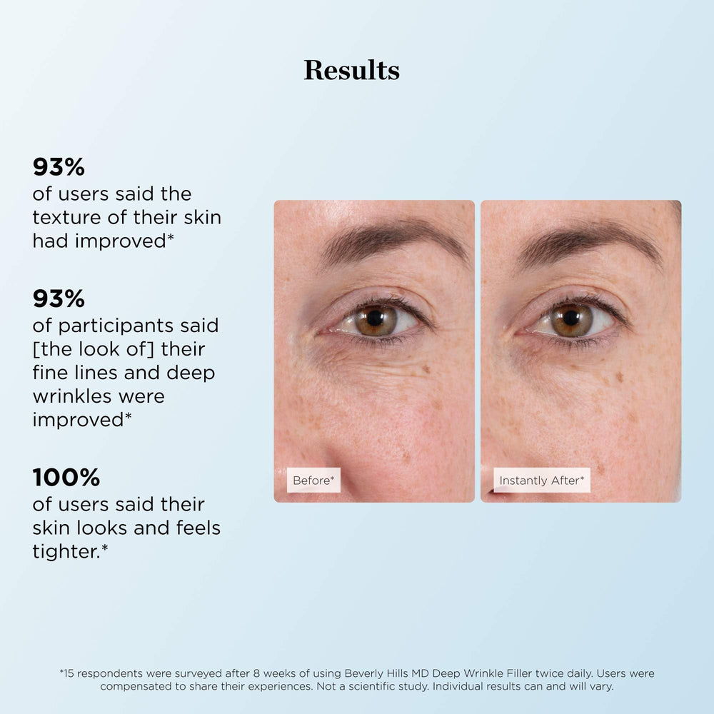 Beverly Hills MD applied around eye crow's feet to instantly soften fine lines