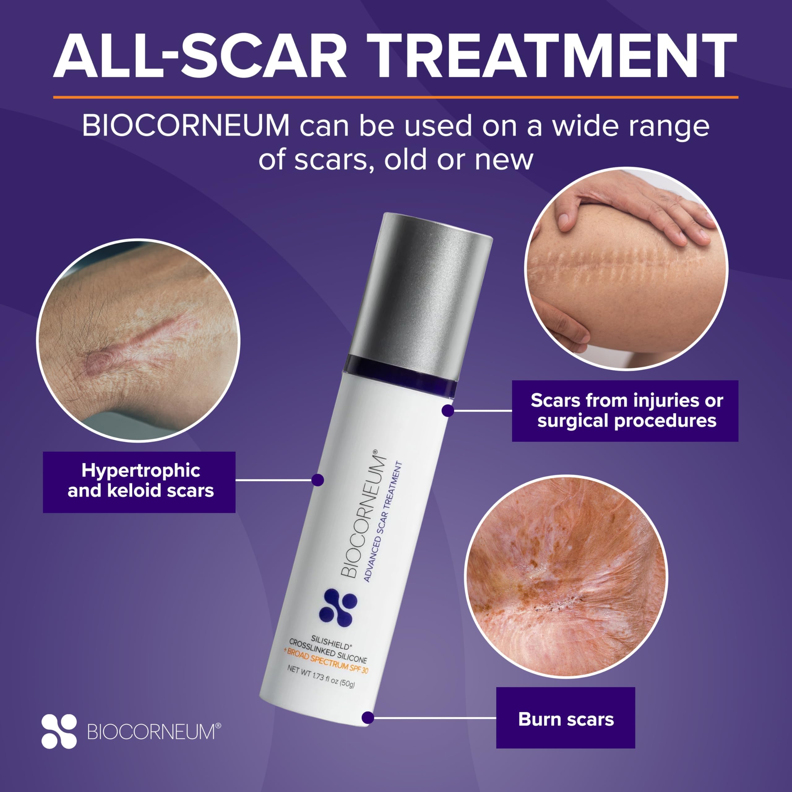 BIOCORNEUM drying to a clear film demonstrating protective scar barrier