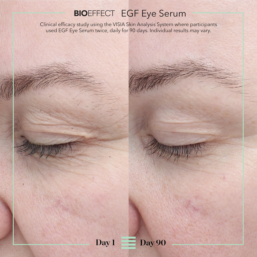 BIOEFFECT serum drop on fingertip showing lightweight texture and quick absorption