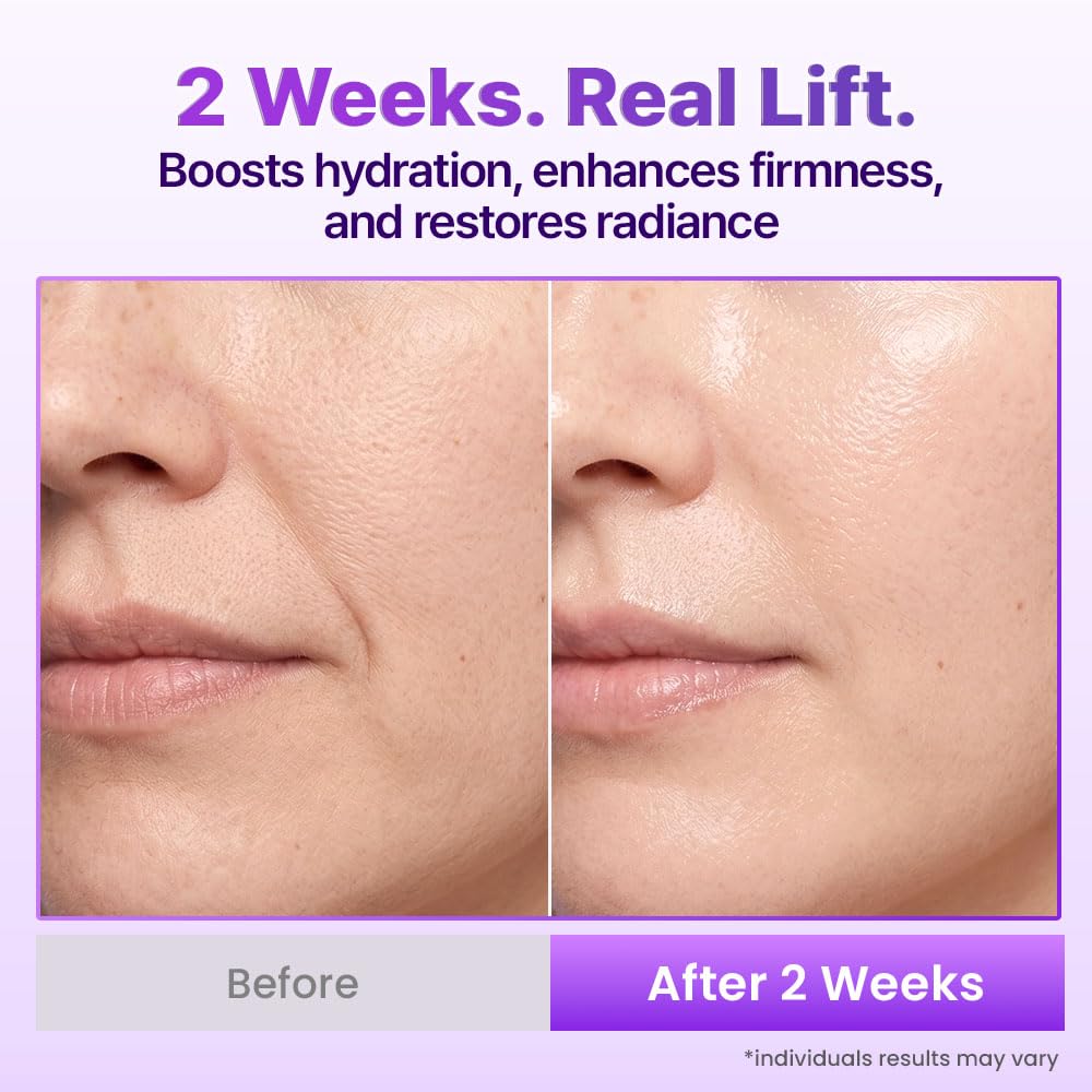 BIOHEAL BOH mist being patted into neck and face for quick lift