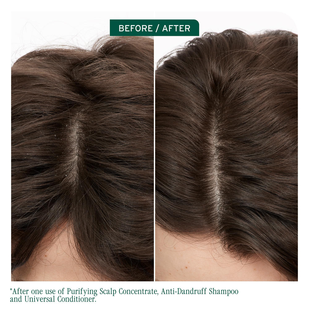 Biolage cap and label detail highlighting product clarity and trust