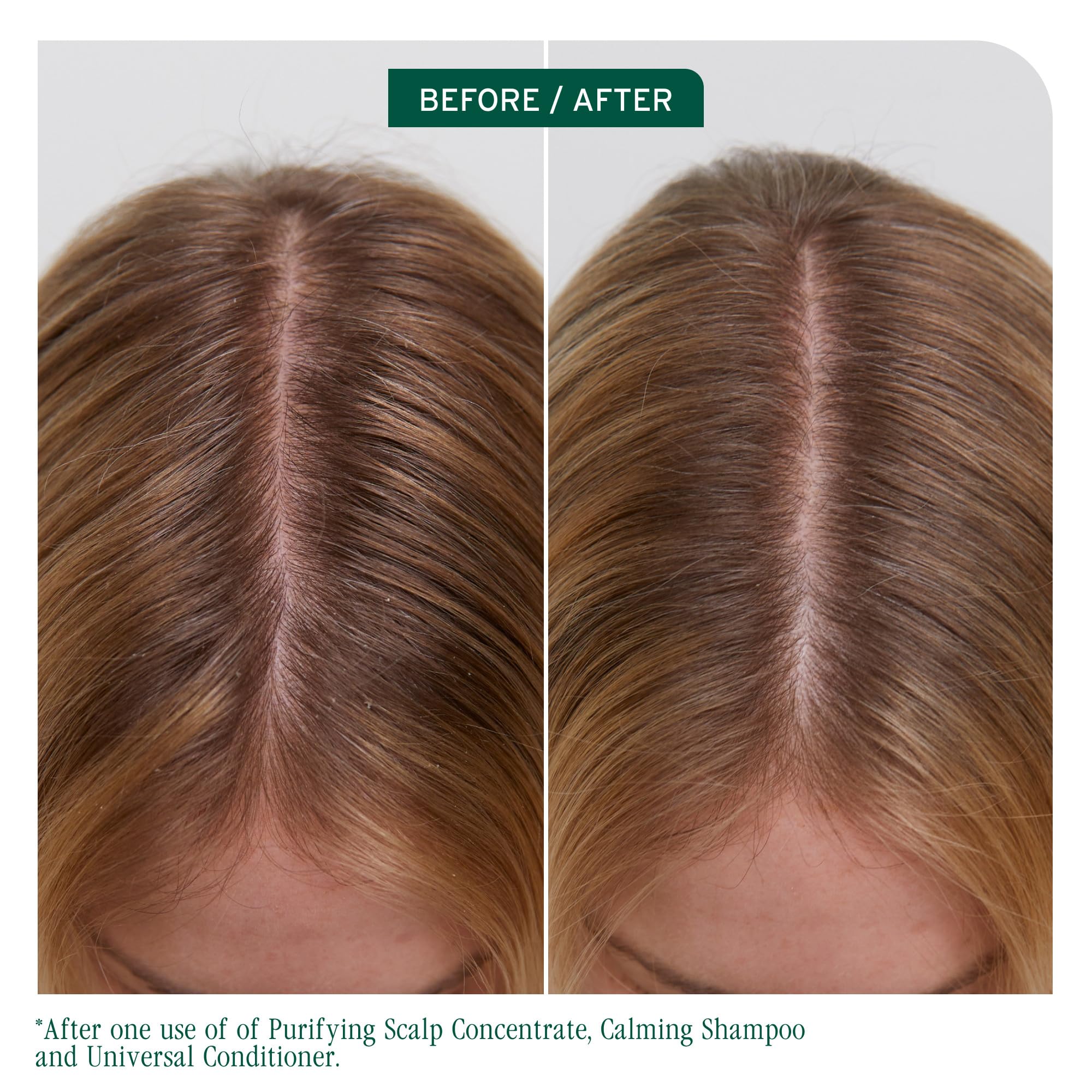Biolage Scalp Sync creamy conditioner texture close-up, brand hydration benefit