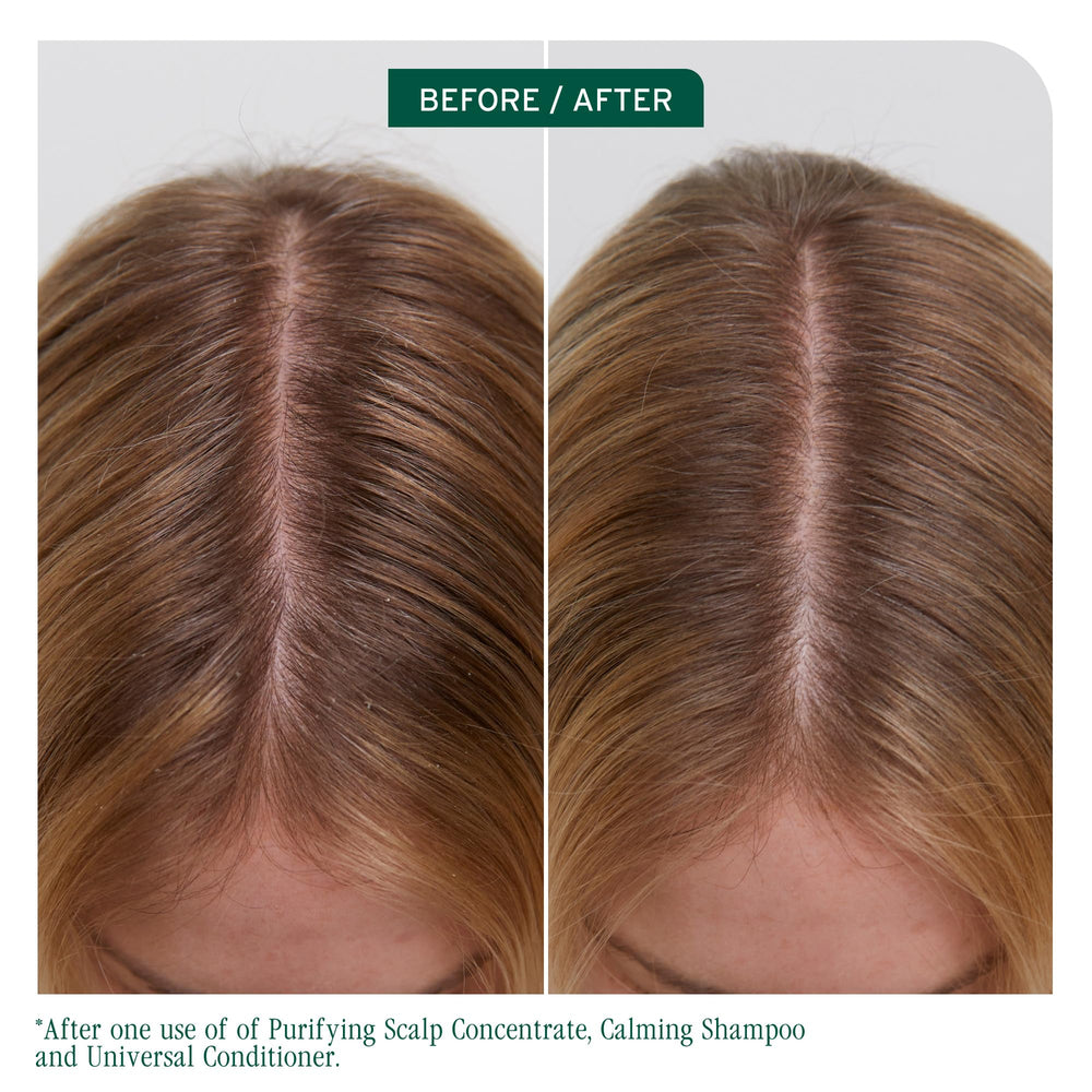 Biolage Scalp Sync creamy conditioner texture close-up, brand hydration benefit